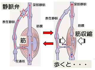 大阪中央病院 診療科のご紹介 皮膚 形成外科 下肢静脈瘤