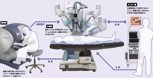 「手術支援ロボット ダヴィンチ」の画像検索結果